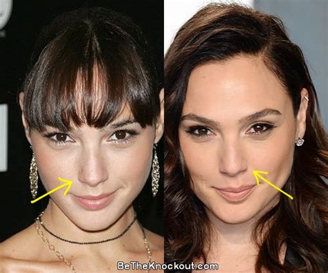 gal gadot|gal gadot before and after.